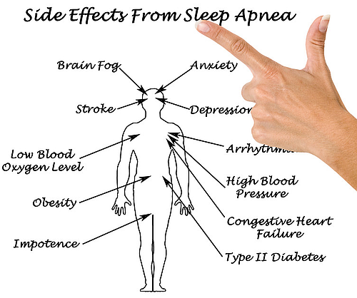 The Side Effect of Sleep Apnea